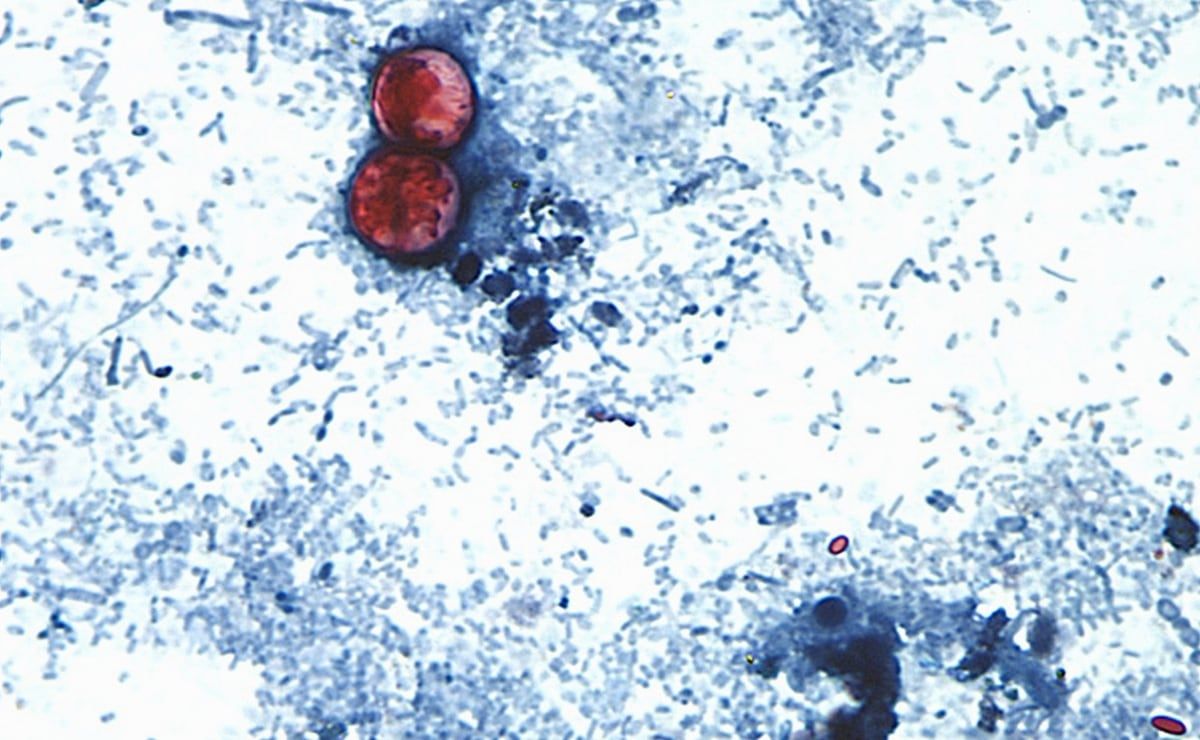 eu-reporta-dos-muertes-por-ciclosporiasis-en-michigan-durante-brote-intestinal